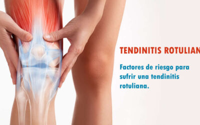 TENDINITIS ROTULIANA